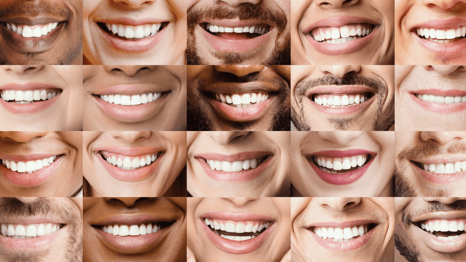 Hollywood Smile in Turkiye hollywood smile